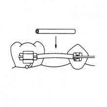 ARCHWIRE SLEEVES & BUMPER TUBING