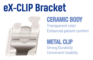 eX-CLIP CERAMIC SELF-LIGATING BRACKET